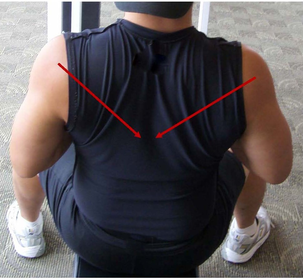 Shoulder Blade Squeeze